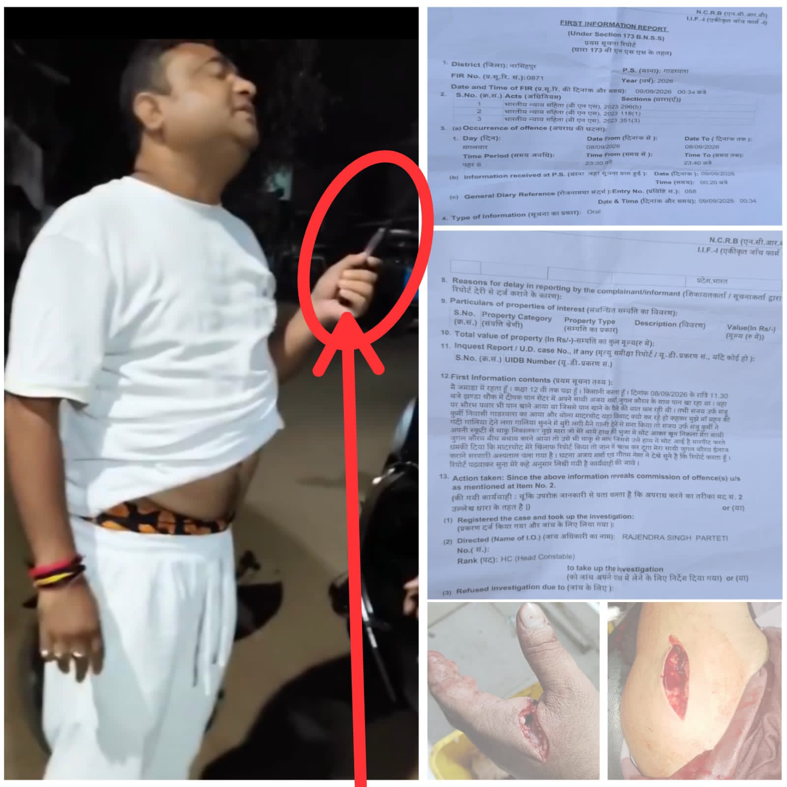 चाकू लहराने का वीडियो वायरल, FIR के बावजूद आरोपी की गिरफ्तारी नहीं  पान खाने के दौरान विवाद में चाकू से हमला करने का आरोप